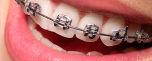 Ortodoncija naslovna