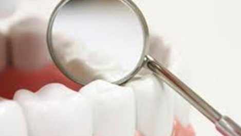 Protetika -krune-i-mostovi