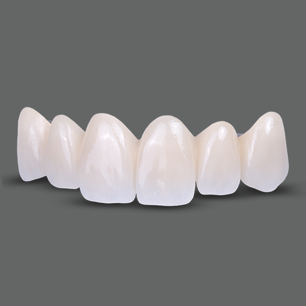 Bezmetalne krunice krune most